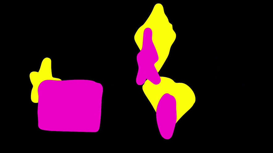 Complex Loop